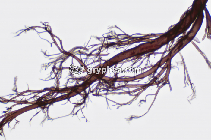 Trachées d'insecte (dissection) x10 - gryphea.org